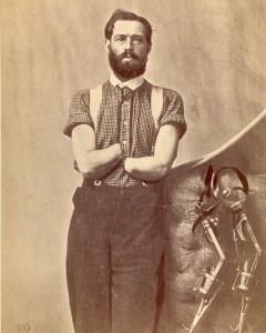 Pvt. Samuel Decker, . Double amputation of the forearms for injury caused by the premature explosion of a gun on 8 October 1862, at the Battle of Perryville, KY. Shown with self-designed prosthetics. Courtesy of the National Museum of Health and Medicine
